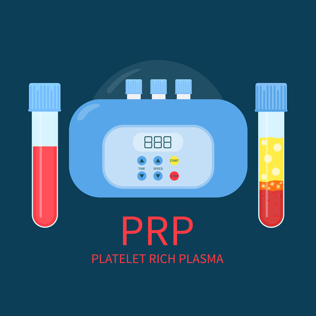 PRP﻿-clinic-TRSSI-3