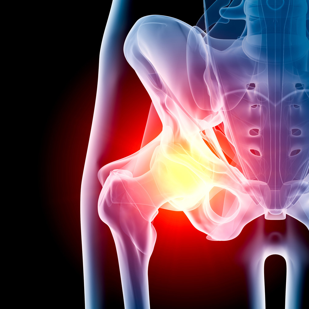 PRP-and-stem-cell-therapy-for-hip-pain-in-Los-Angeles-TRSSI-1