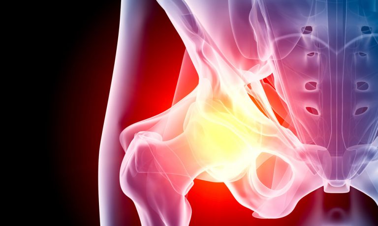 PRP-and-stem-cell-therapy-for-hip-pain-in-Los-Angeles-TRSSI-1